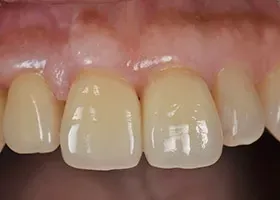 治療後