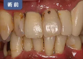 治療前