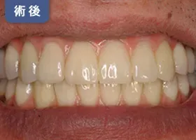 治療後