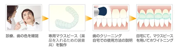 歯の色の確認